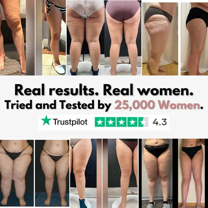 Cellumove 3D legging - say goodbye to lipedema pain and swelling naturally