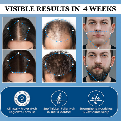 Neluval Hair Growth Roll on Serum