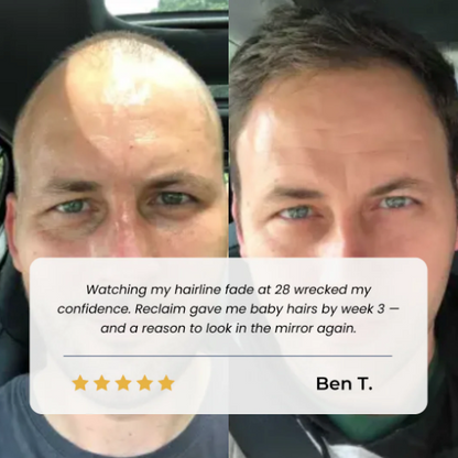 Neluval Hair Growth Roll on Serum